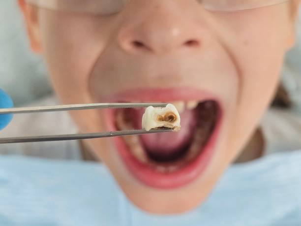 Best Walk-In Emergency Dental Services in New Roads, LA